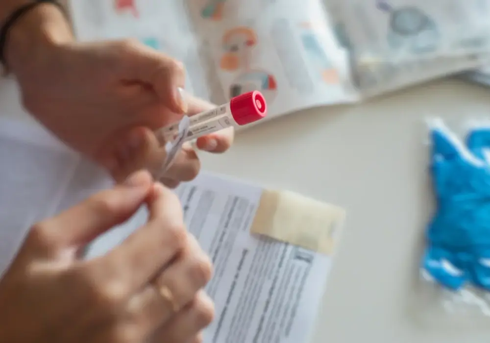 SHBG kiedy badać: najlepszy czas na test i jak się przygotować