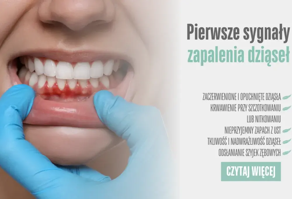 Dlaczego puchną dziąsła? Poznaj przyczyny i skuteczne sposoby leczenia