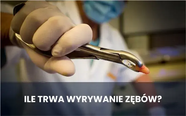 Ile trwa wyrywanie zęba 8? Poznaj czas i co warto wiedzieć przed zabiegiem
