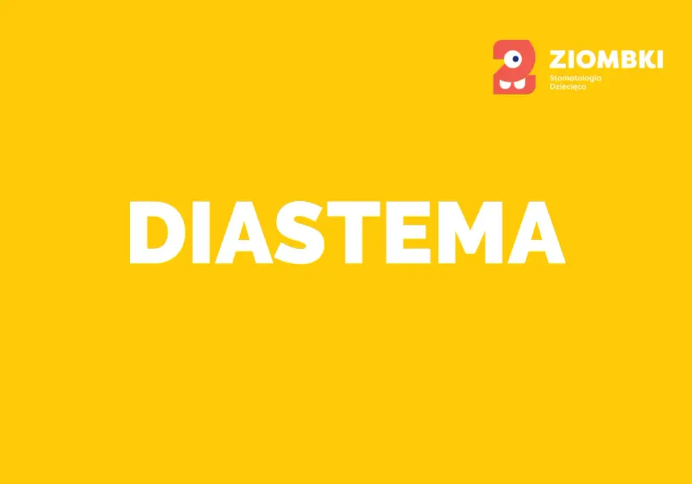 Jak się nazywa przerwa między zębami i dlaczego warto ją znać