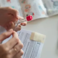 SHBG kiedy badać: najlepszy czas na test i jak się przygotować