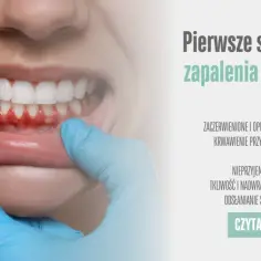 Dlaczego puchną dziąsła? Poznaj przyczyny i skuteczne sposoby leczenia