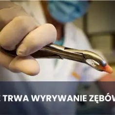 Ile trwa wyrywanie zęba 8? Poznaj czas i co warto wiedzieć przed zabiegiem