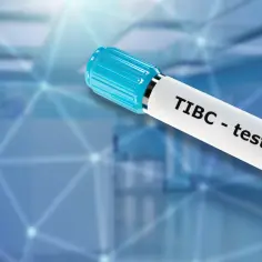 TIBC co to za badanie? Kluczowe informacje o badaniu żelaza