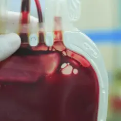 Trombofilią jakie badania: kluczowe testy dla Twojego zdrowia