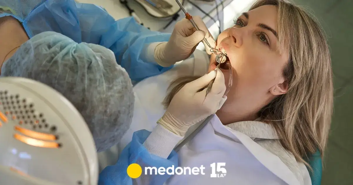 Zdjęcie Czy znieczulenie u dentysty jest na NFZ? Sprawdź warunki i opcje