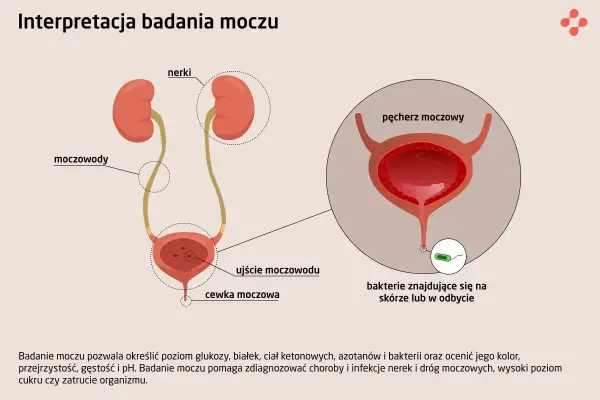 Leukocyty w moczu - interpretacja wyników. Kiedy martwić się?