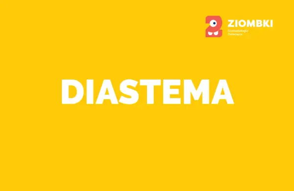 Jak się nazywa przerwa między zębami i dlaczego warto ją znać